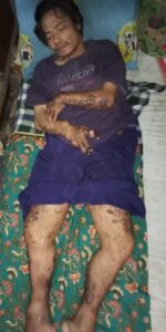 Mari Beri Harapan Baru Untuk Pak Wawin, Berharap Pemerintahan Peduli !! Mari Beri Harapan Baru Untuk Pak Wawin, Berharap Pemerintahan Peduli !!