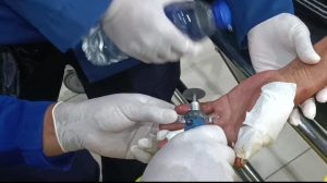 Cincin Terjebak Dijari Mukmin Yang Sedang Terluka Parah, Rully dan Tim Hadir di RSUD Bob Bazar, SKM Segera Melakukan Evakuasi