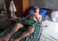 Mari Beri Harapan Baru Untuk Pak Wawin, Berharap Pemerintahan Peduli !!