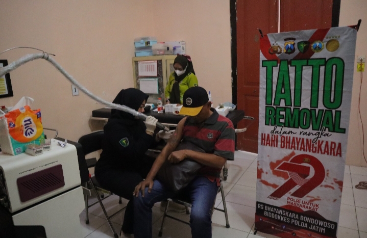 Polres Situbondo Beri Layanan Hapus Tato Gratis di Hari Bhayangkara ke -79 Polres Situbondo Beri Layanan Hapus Tato Gratis di Hari Bhayangkara ke -79