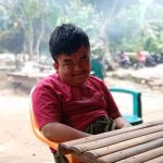18 Tahun Penderita Hidrosefalus di Rangai Tri Tunggal Berharap Bantuan Kursi Roda